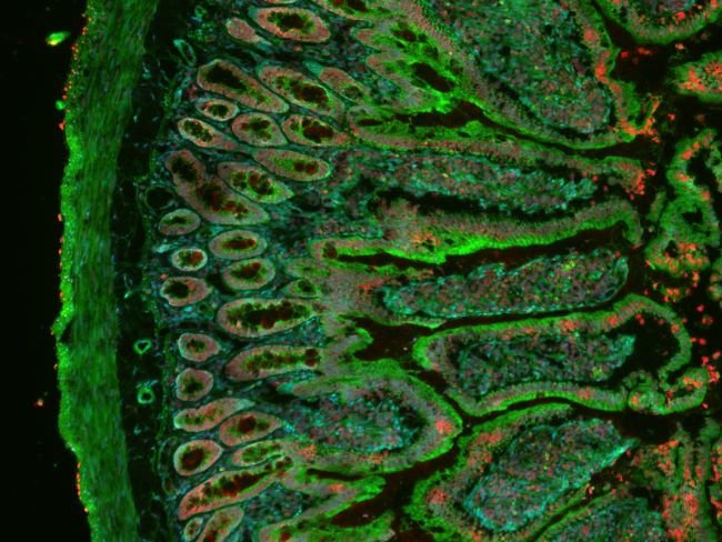 CellMask Green Actin Tracking Stain labeling in IHC protocol